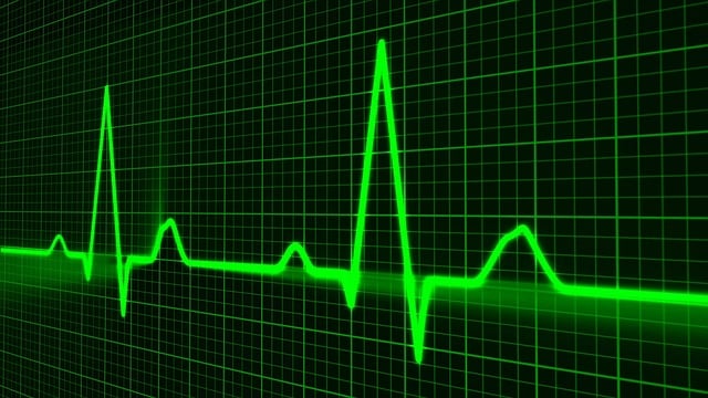 pulse trace image: green on black background