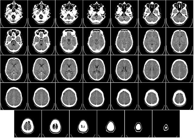 Example of a head CT scan